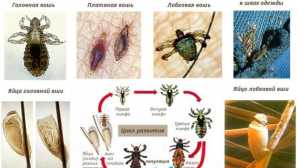 Pećnica: znakovi, liječenje i prevencija